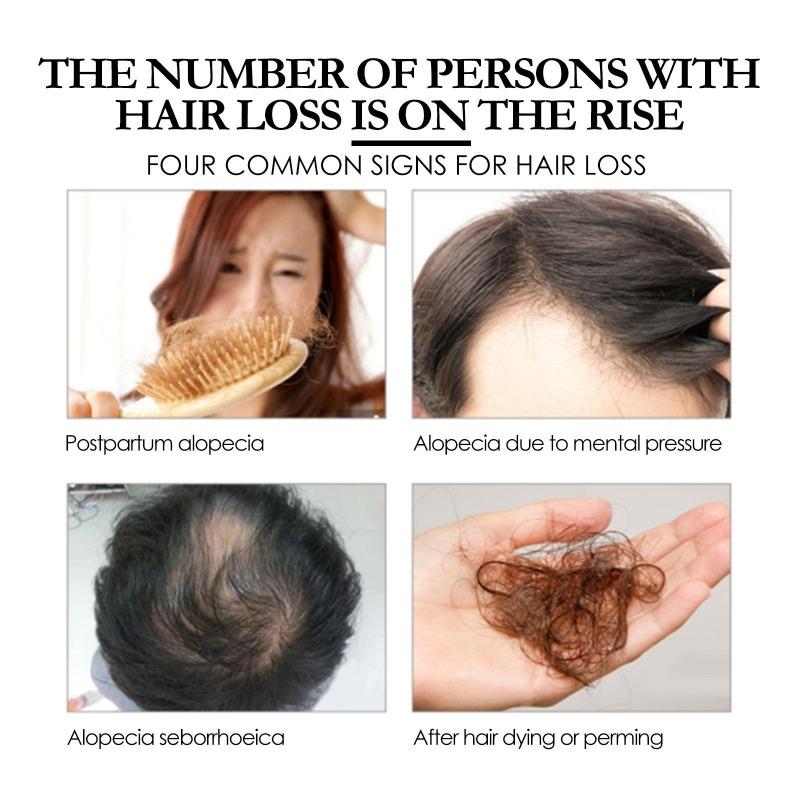 30 ml dichtes Haarspray spendet der Kopfhaut tiefenwirksam Feuchtigkeit, repariert das Haar, festigt das Haar und ist kompaktes Haarspray