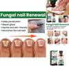Eelhoe Nail Care Solution For Fungal Toenail Treatment With Nourishing Moisture