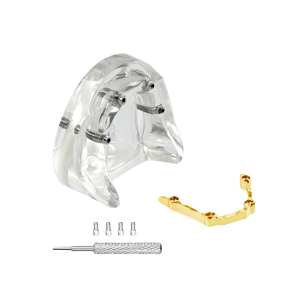 Dental Teeth Model With Implants Gold/Silver Bar Type Overdenture Restoration Treatment Typodont For Dentist Patient Teaching