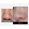 sungboon editor Blackhead Melting Clear Pad 30P