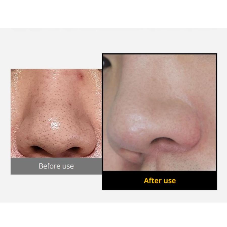 sungboon editor Blackhead Melting Clear Pad 30P