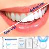 Whitening Smilekit Teeth Light Lamp Kit Tooth Whitener Oral Care Hygiene White