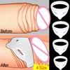 S/L Foreskin Corrector  Male Glans Exposure Delayed Ejaculation Penis Erection Penis Ring Soft Silicone Elastic Adult Toy