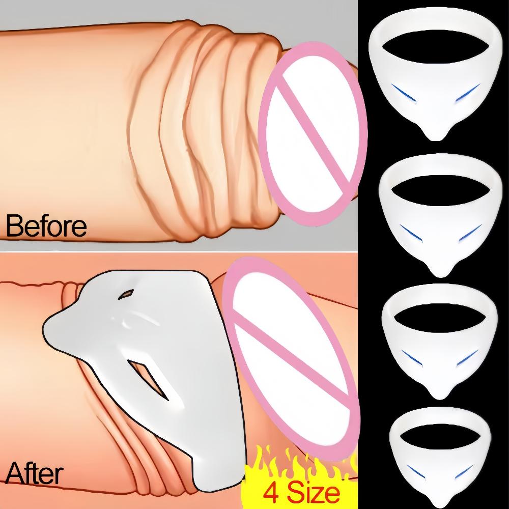 S/L Foreskin Corrector  Male Glans Exposure Delayed Ejaculation Penis Erection Penis Ring Soft Silicone Elastic Adult Toy
