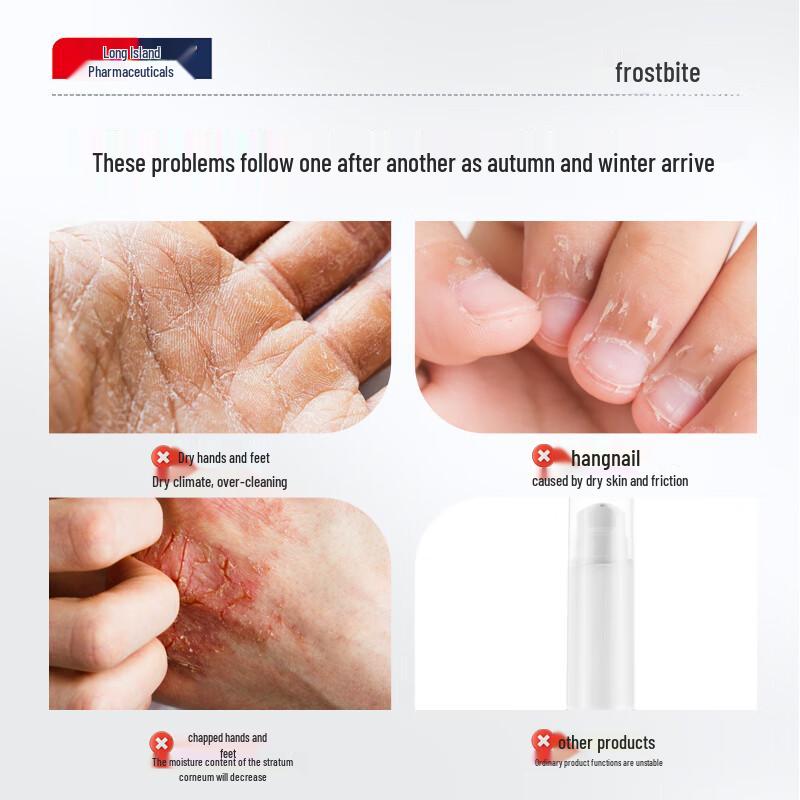 Changdao Chilblain Relief Cream