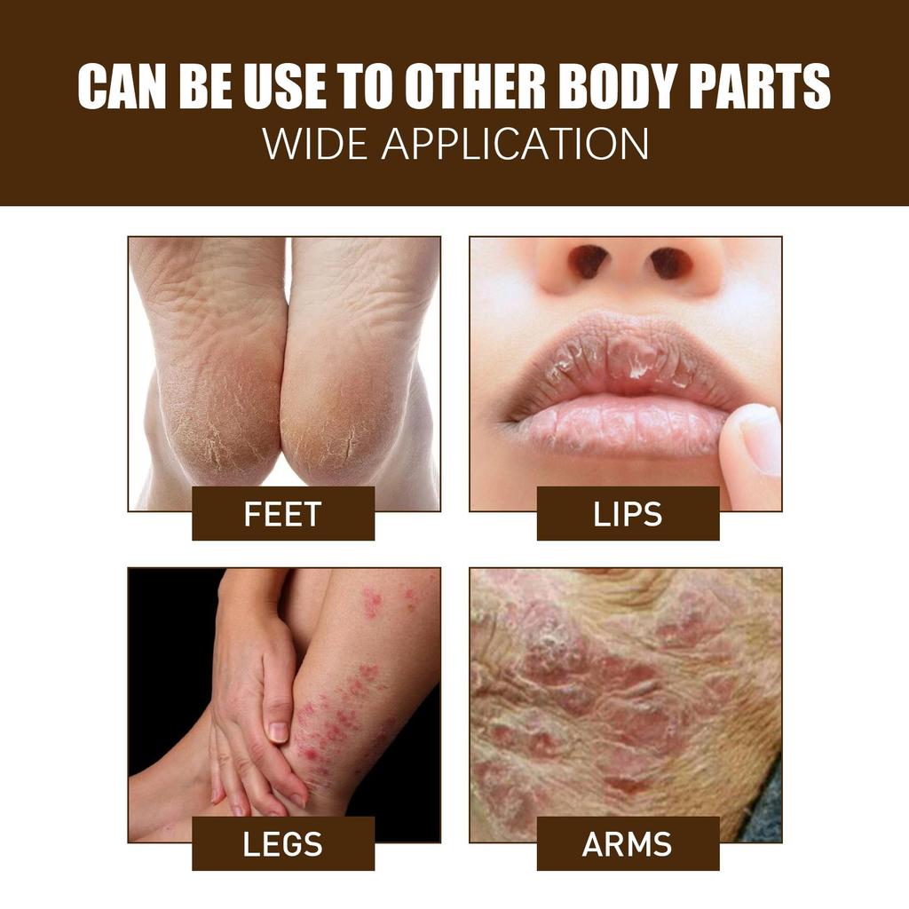 15g Cracked Heel Treatment Cream Repairing Feet Anti-Dry Cracked Peeling Chapped Moisturizing Foot Cream