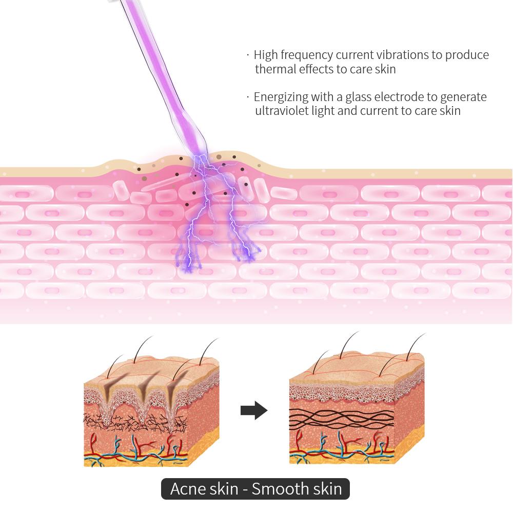 4-IN-1 Portable High Frequency Facial Beauty Machine Electrode Purple Light Glass Tube Wand Acne Massage Facial SPA Skin Care