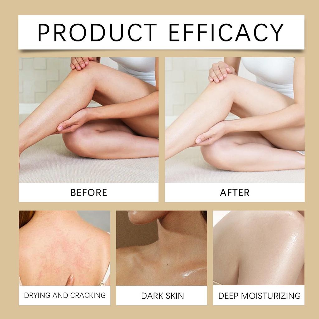 Cremă de îngrijire a pielii cu venin de albine, Cremă calmantă, hidratantă, antiinflamatoare, cu ulei de arbore de ceai