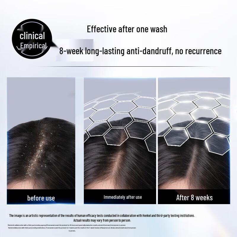 Schwarzkopf Dandruff Control Shampoo Set