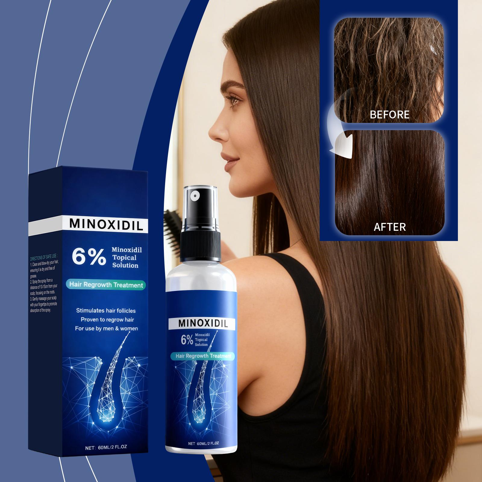 

Міноксидил 6% Розчин для місцевого застосування - Сироватка для росту волосся для рідіючого волосся, Швидкодіючий спрей для відновлення росту волосся для чоловіків та жінок 60ml