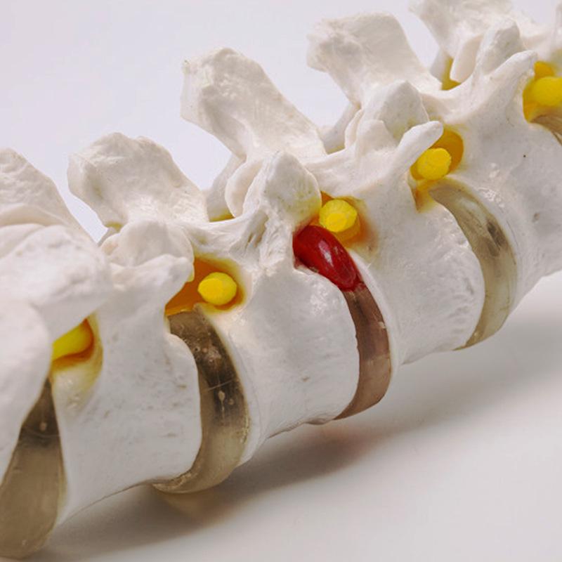 Natural Lumbar Vertebrae with Coccyx Model - Teaching Tool