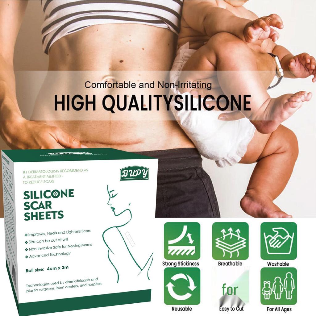 Adjustable Silicone Gel Scar Sticker Roll for Surgical Scar Repair