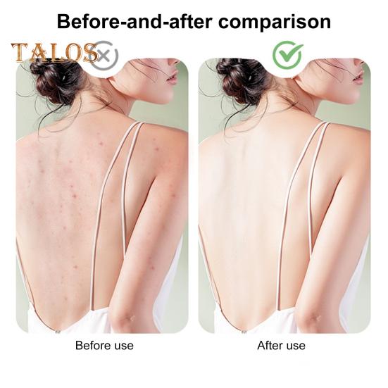 Elektrický koupelový kartáč s 5 kartáčovými hlavicemi Vodotěsný Dobíjecí Design s dlouhou rukojetí 3-rychlostní rotace Sprchový masážní kartáč