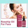 Hoygi Rosehip Oil For Nourishing Hydration And Pore Refinement In Facial Care