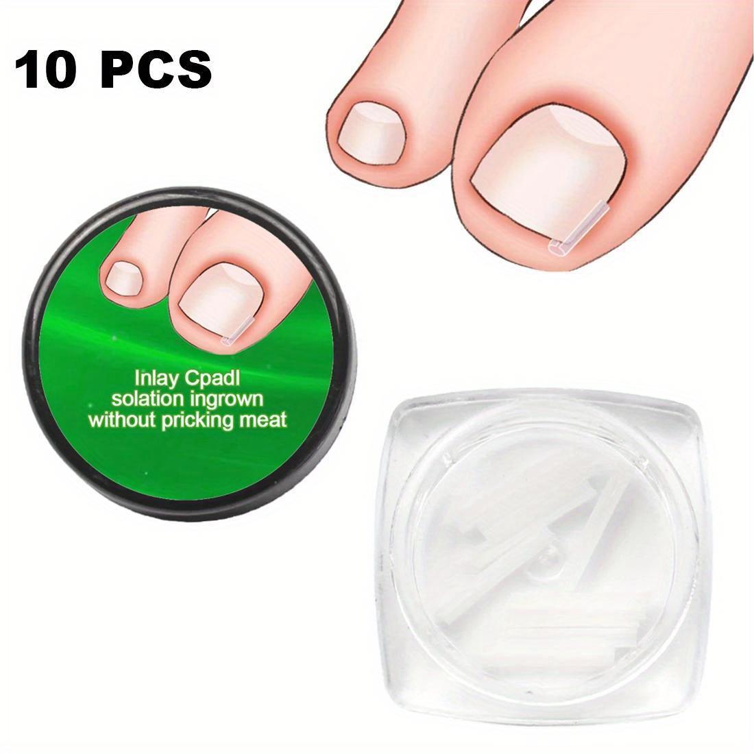 

10 шт. кусачек для выпрямления ногтей на ногах, набор инструментов для коррекции ногтей, эластичные наклейки для ухода за ногтями, педикюр, инструменты для ухода за ногами as the picture