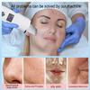 Ultrasonic Face Scrubber Facial Peeling Machine Black Dots Blackhead Remover Acne Pore Deep Cleaning Ultrasonic Skin Scrubber