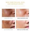 Freckle Whitening Cream Melasma Dark Spots Pigmentation Removal Product Fade Stain Melanin Fast Repair Brighten Korean Skin Car