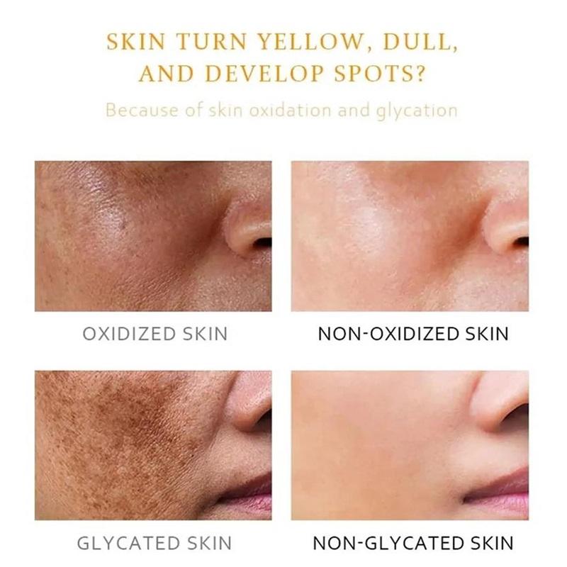 Freckle Whitening Cream Melasma Dark Spots Pigmentation Removal Product Fade Stain Melanin Fast Repair Brighten Korean Skin Car