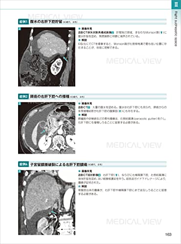Canal Foramen, Fissure, Space & Membrane: Topographical Anatomy and Image Diagnosis for Interpretation