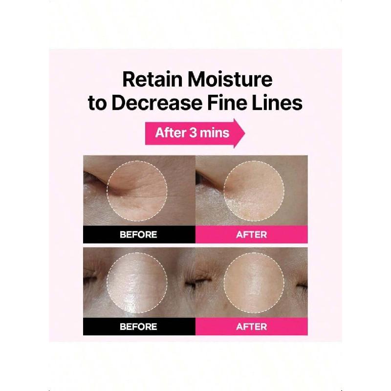 Isoi Blemish Care Eye & Wrinkle Patch 90g Hyaluronic Acid Eye Masks For Hydration & Firming With Bulgarian Rose Oil Targeted Care For Fine Lines