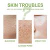 1ks 50g Sopečná bahenní bublinková pleťová maska ​​Hloubkové čištění akné a pupínků Eliminace akné Zpevnění pórů