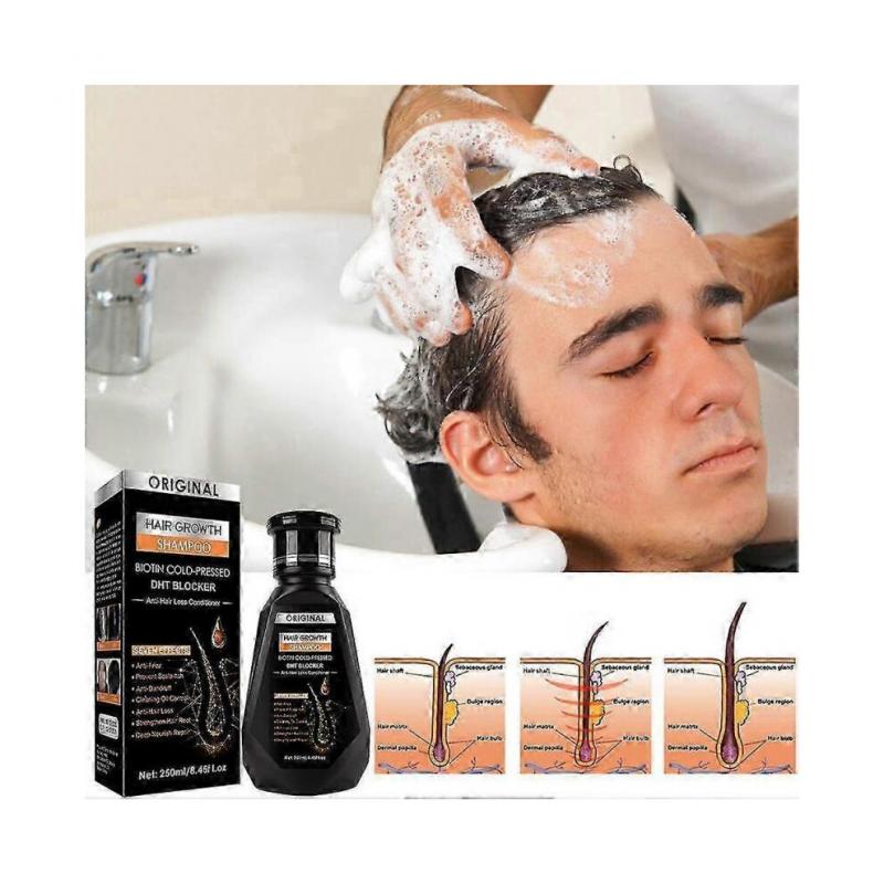 Ginger Shampoo Hair Treatments Hair Growth Hair Care Anti-hair Loss Hair