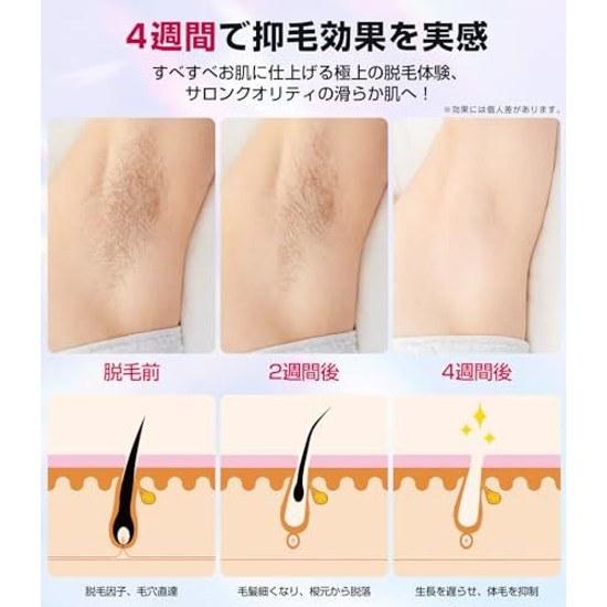 Hair Removal Device VIO CompatibleSalon-Level IPL Light Instant 10 Cooling Low IrritationBeard Mens Womens Full Body Applicable Sapphire High Power 1