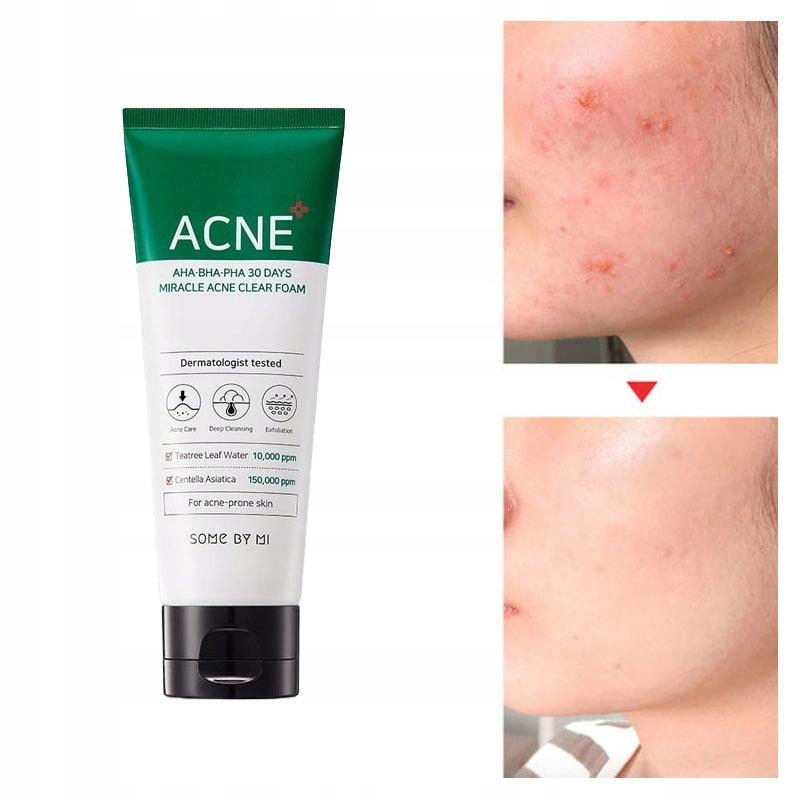 Some By Mi Aha Bha Pha 30 Days Miracle Foam Cleansing Foam 100