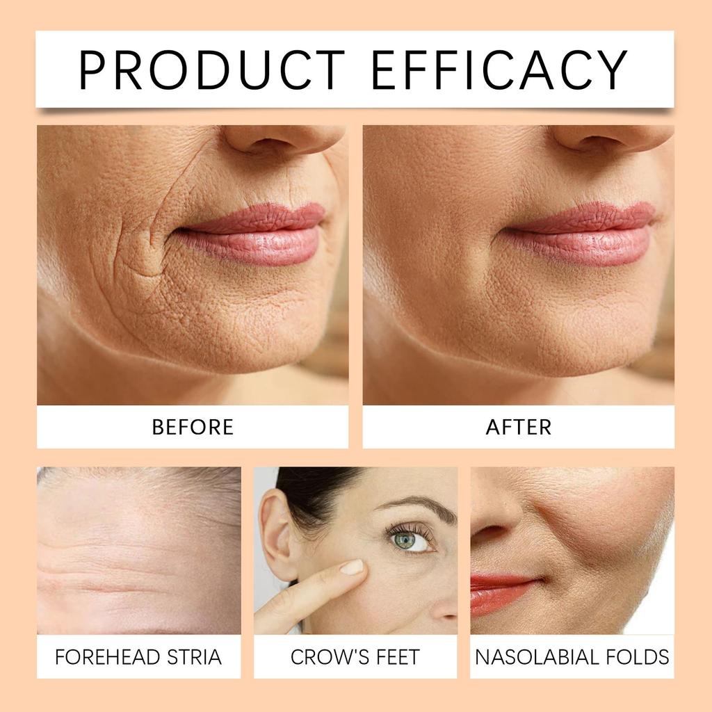 Hoygi Bee Venom Firming Essence Stick Nourish & Lift Skin Elasticity Moisturize & Emollient Facial Firming Skin Care Essence