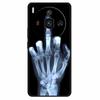 Für Nubia Z50S Pro Hülle Mode Schutz Silikon Bemaltes TPU Hülle für ZTE Nubia Z50S Pro 5G Cover NX713J Süß Weich Löwen