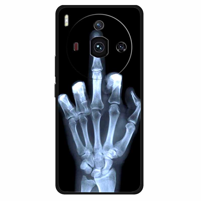Für Nubia Z50S Pro Hülle Mode Schutz Silikon Bemaltes TPU Hülle für ZTE Nubia Z50S Pro 5G Cover NX713J Süß Weich Löwen