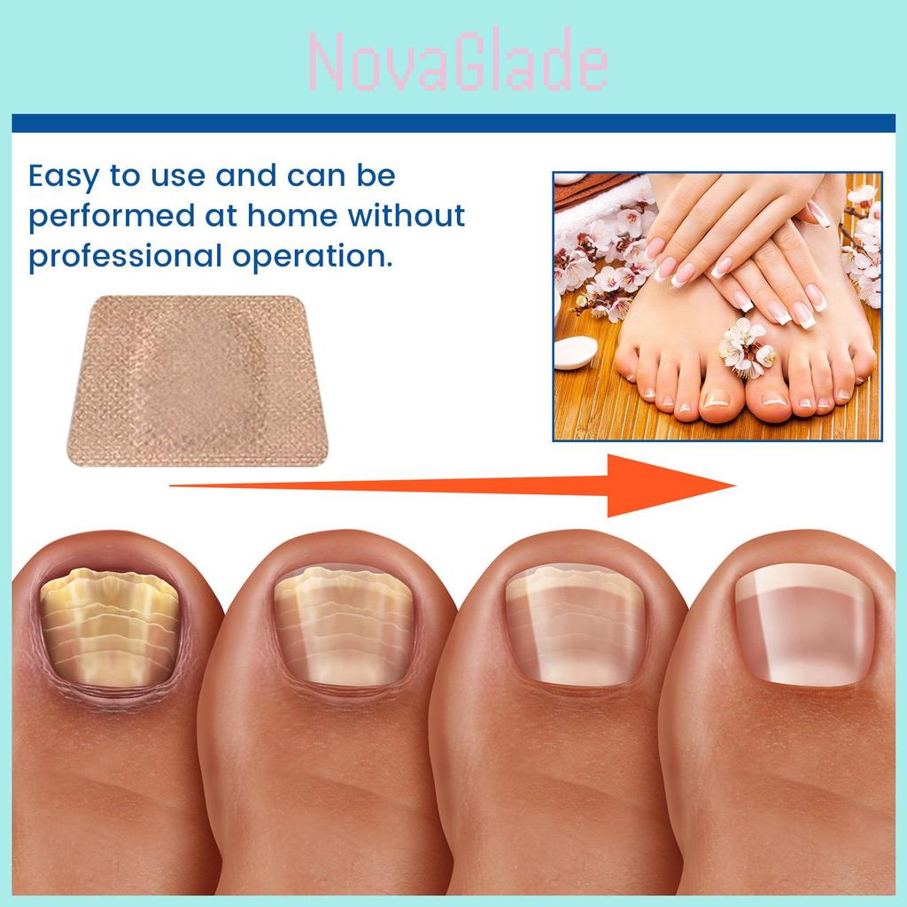 Ximonth Nagelpflege-Pflaster für gesunde Zehen und starke Nägel mit reparierender Formel