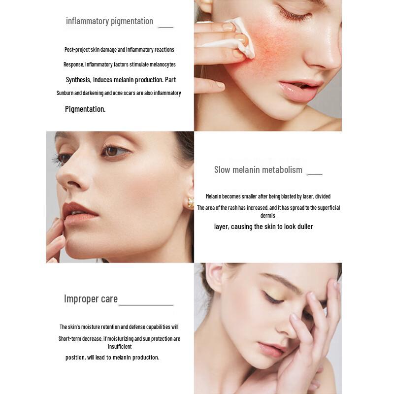 Yifuquan Clinic-Grade Tranexamic Acid Brightening Serum 30ml