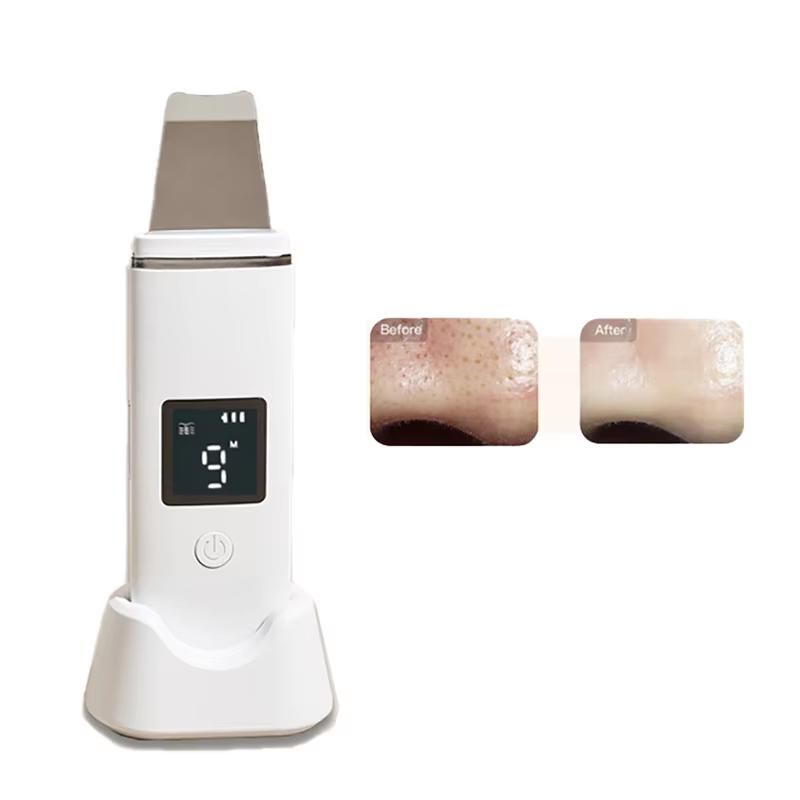 Face Cleaning Spatula Ultrasonic Skin Scrubber Exfoliate Facial Dead Skin Sonic Peeler Facial Skin Scrubber USB wireless charger