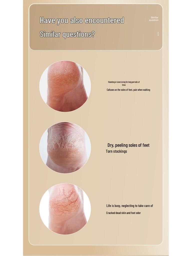 Wasserdichte elektrische Fußfeile & Hornhautentferner mit Staubsauger zur Pflege abgestorbener Haut