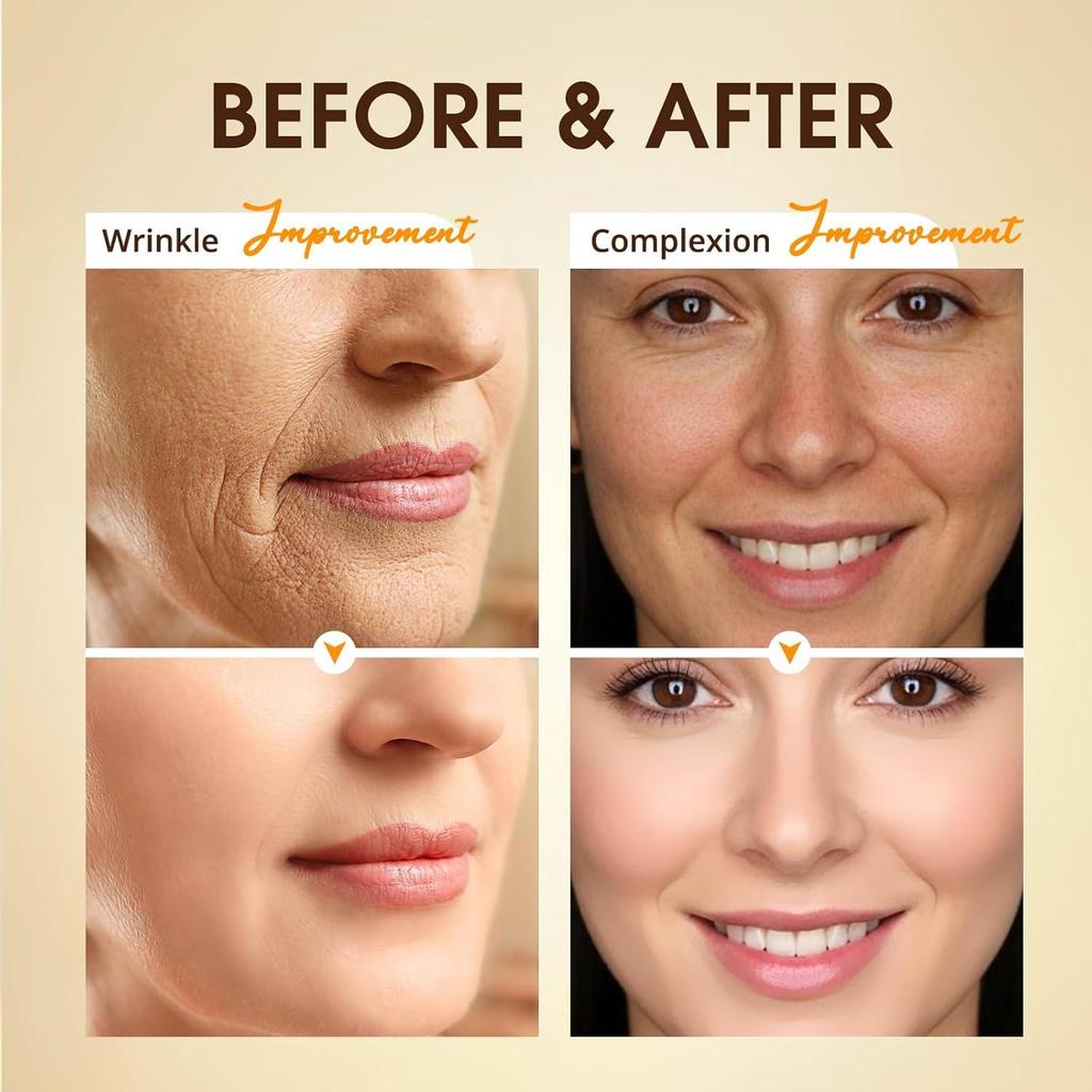 Retinol Facial Serum-Moisturizes And Htdrates The Skin To Keep The Horny Layer Moist And Soft-Suitable For All Skin Types, 30ml