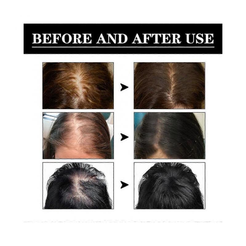 3pcs Noor Hair Growth Serum African Olives, Noor Love Hair Growth Serum