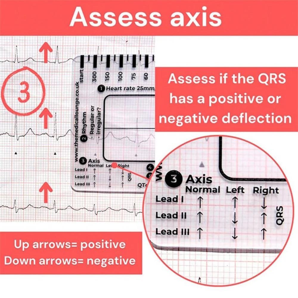 Interpretation Ecg/Ekg Reference Guide Portable Pocket Ekg Interpretation Ruler  for ECG Assessment