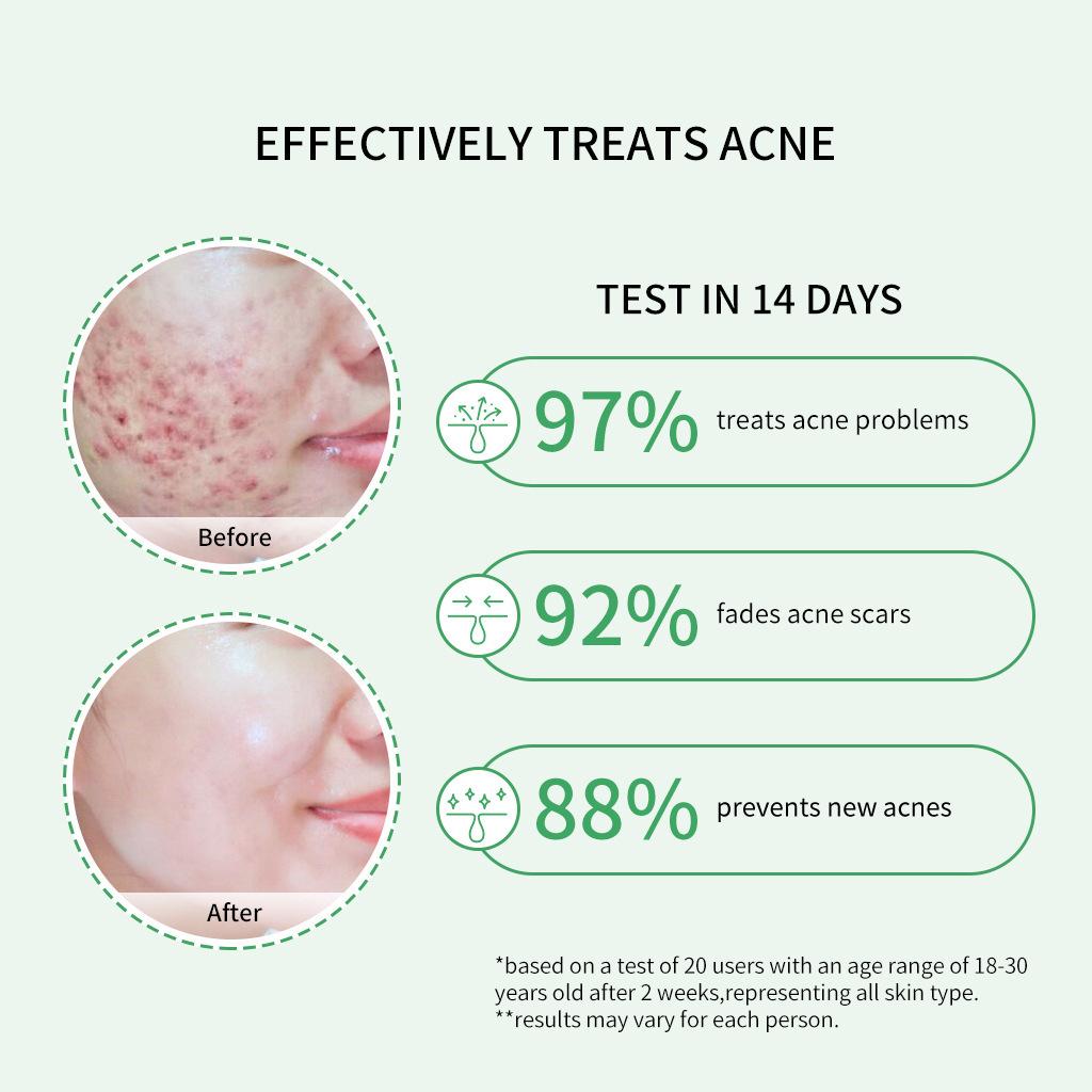 PIBAMY Centella Asiatica Salicylic Acid Essence Ceramide Mineral Skin Care Moisturizing Liquid