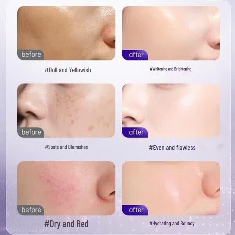 Vettes 377 Whitening & Anti-Aging Face Cream