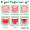 EELHOE Tongue Repair Spray Repair White Tongue Relief Dry Swollen Tongue Oral Care Spray
