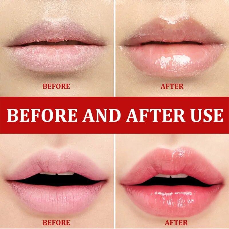 Aufhellendes rosa Mund-Lippen-Serum, bleichendes rosafarbenes, feuchtigkeitsspendendes, reparierendes, aufhellendes Lippenbalsam-Lippenpflege