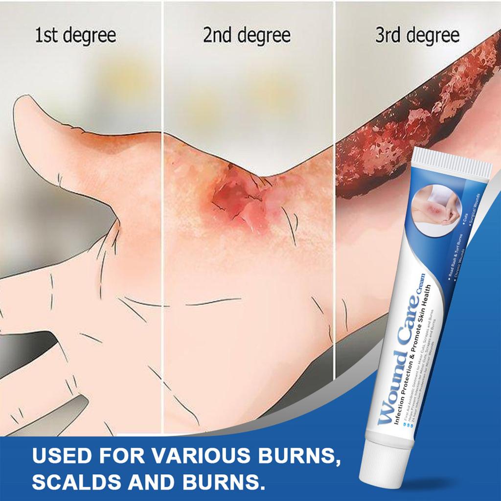 Burns And Scalds Care Ointment To Skin Fever And Burns 20g