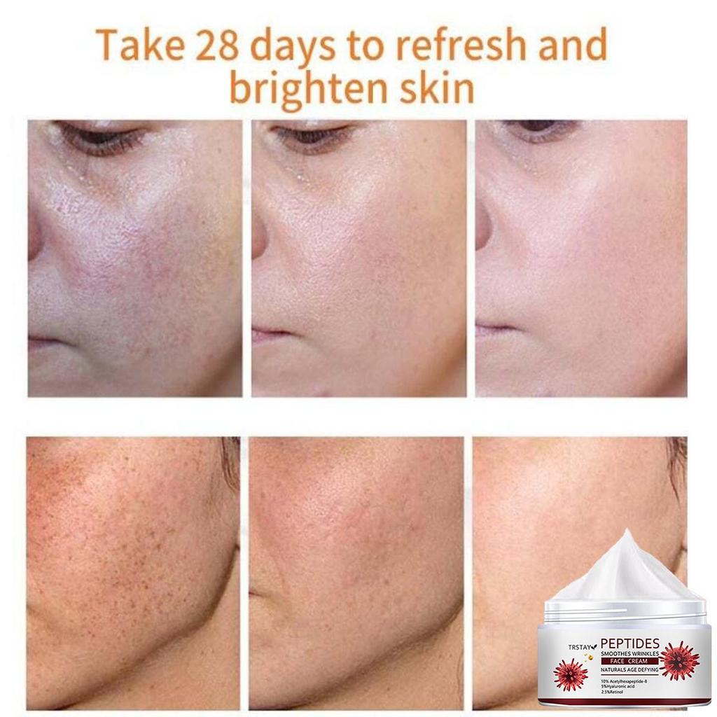 A Moisturizing Cream That Improves Skin Elasticity, Brightens Skin Tone, Helps Reduce Wrinkles, and Absorbs Quickly