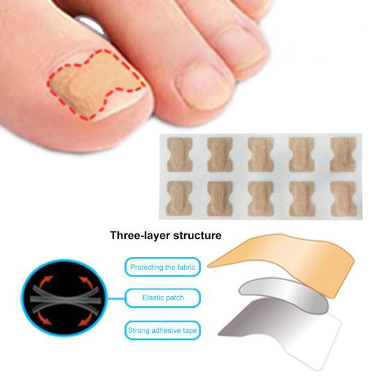 Yousheng 20Pcs Ingrown Toenails Correction Patches Breathable Painless Ingrown Toenail Treatment Tool Professional Ingrown Toenail Straightener