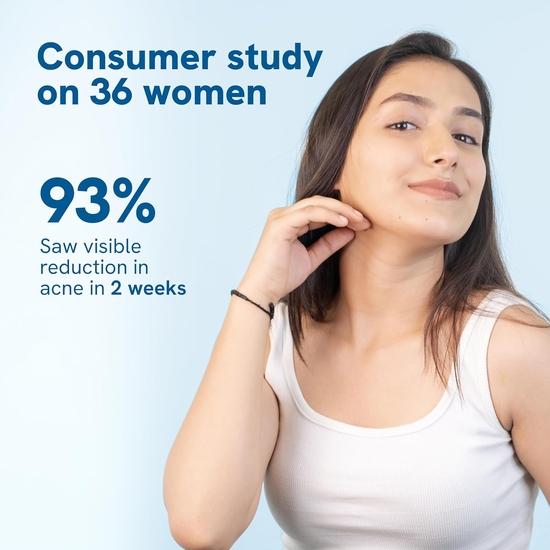 Be Bodywise 2% Salicylic Acid Face Wash for Acne Prone skin | For Oily & Sensitive skin | Developed by Dermatologists | 100ml