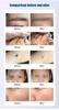 Best Sellers Laser Beauty Machine Portable Q-switch ND YAG Laser Tattoo Removal Pigmentation Removal Carbon Peeling Machine