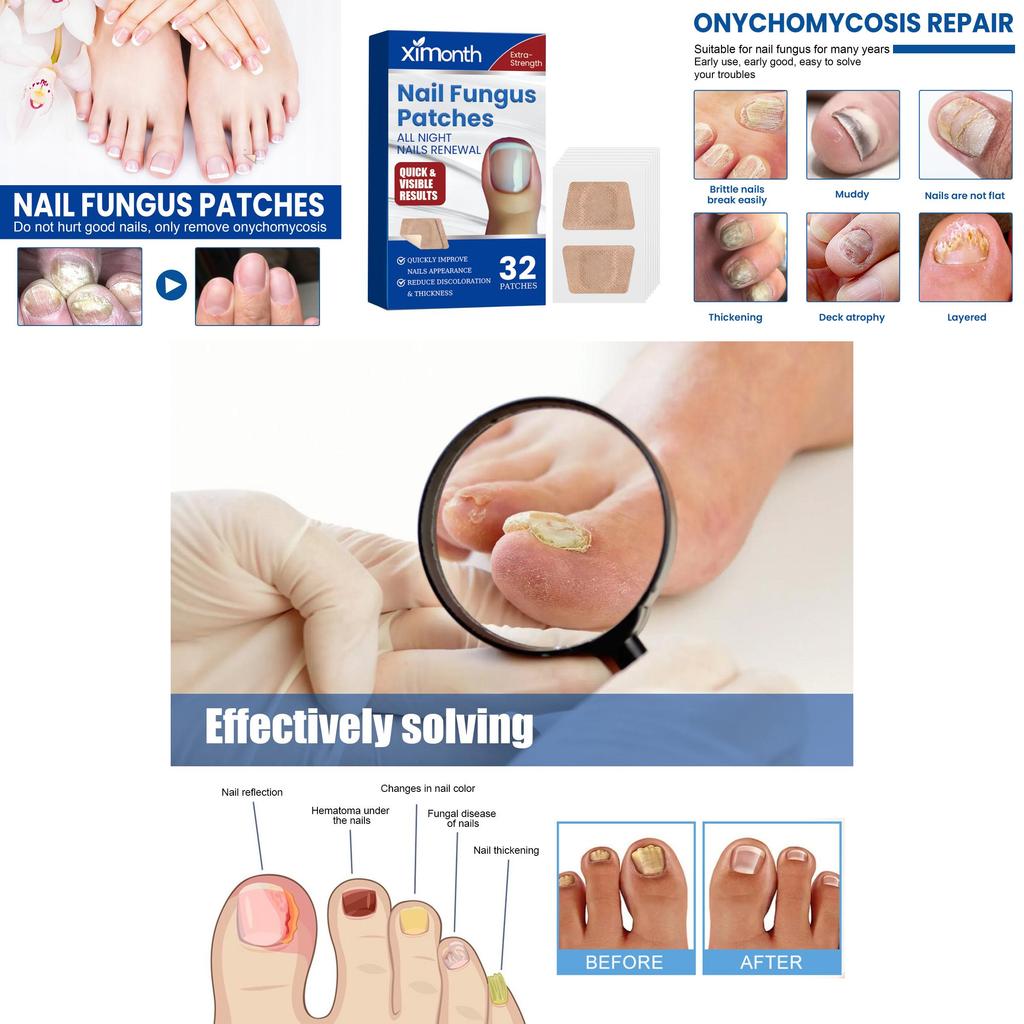 Ximonth Nail Care Patches Repairing Thickening Strengthening For Damaged Nails