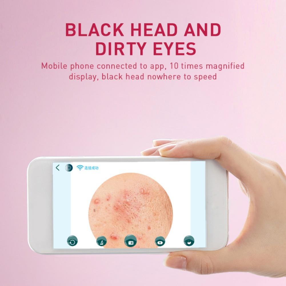 20X Microscope 5.0 Megapixels with 6 Replaceable Probes for Facial Pore Clean Compatible with Phone/Tablet/Computer,White KUYT Electric Blackhead Vacuum with WiFi HD Camera 20X Microscope 5.0 Megapixels with 6 Replaceable Probes for Facial Pore Clean Compatible with Phone/Tablet/Computer,White KUYT Electric Blackhead Vacuum with WiFi HD Camera