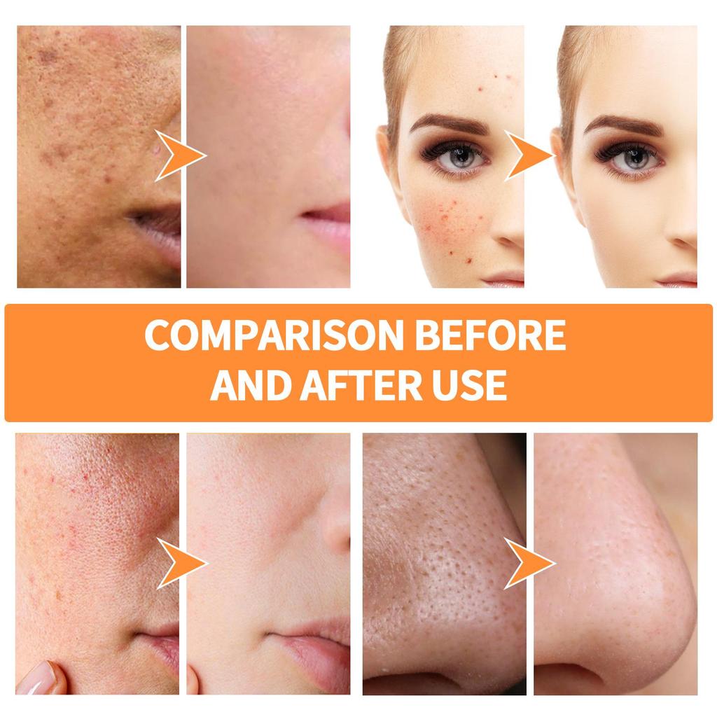 EELHOE Turmeric Mud Mask Stick Anti-Acne Pore Cleansing Solid Mask